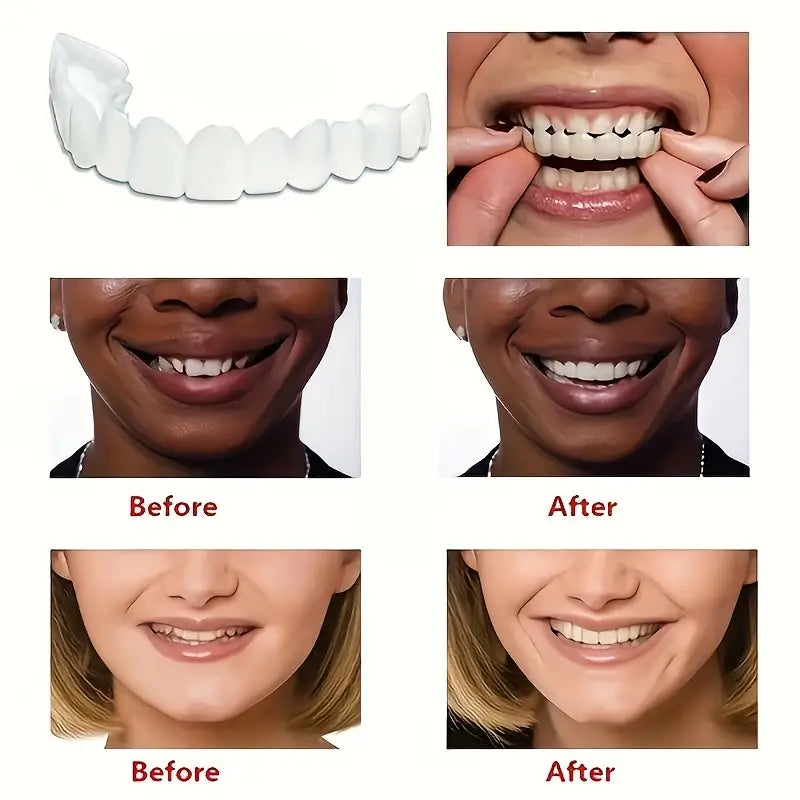 Snap On Smile Veneers Moldable False Artificial Braces Teeth Kits For Men And Women