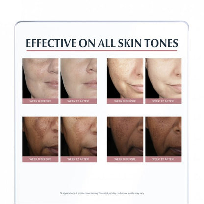 Eucerin Anti-Pigment Spot Corrector 5ml